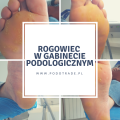 AEP - Rogowiec - w gabinecie podologicznym