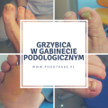 AEP - Grzybica w gabinecie podologicznym