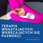 Podologiczna terapia wrastających i wkręcających się paznokci