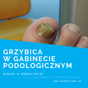 Grzybica w gabinecie podologicznym