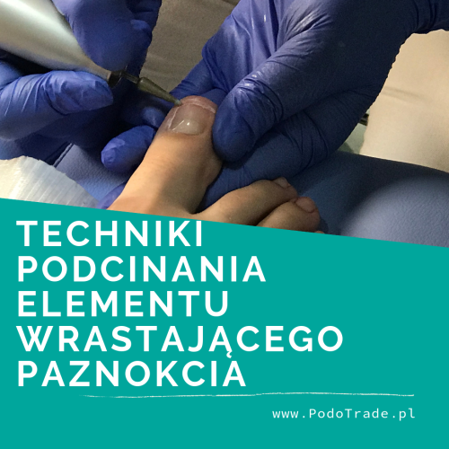 12. Podologiczne techniki elementu wrastajacego paznokcia.png