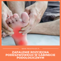 AEP - Zapalenie rozcięgna podeszwowego w gabinecie podologicznym